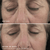 brightening-eye-masks