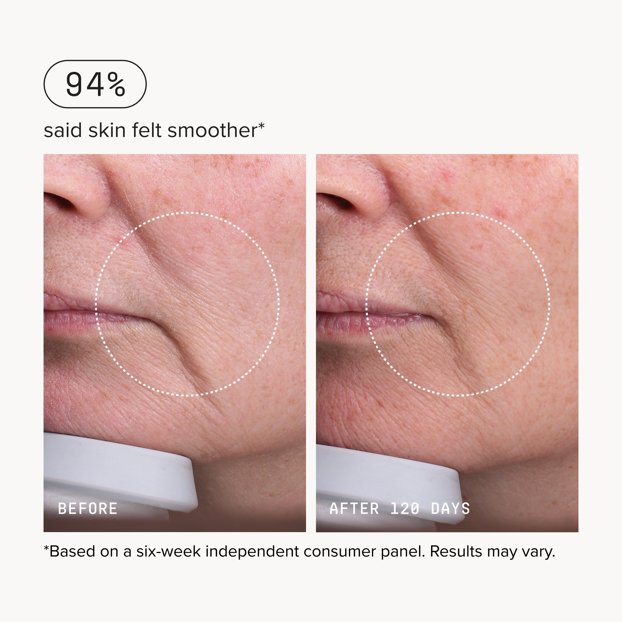 Needle-less® Serum – DRMTLGY