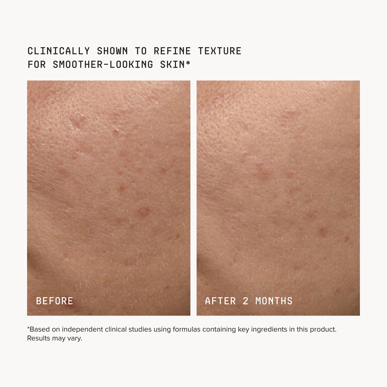 glutathione review before and after The amazing results of our Treatment The pictures speak volumes- consistent treatments show results Call 0161 768 7674 to book in a free consultation with our team start your skin iv glutathione skin whitening review