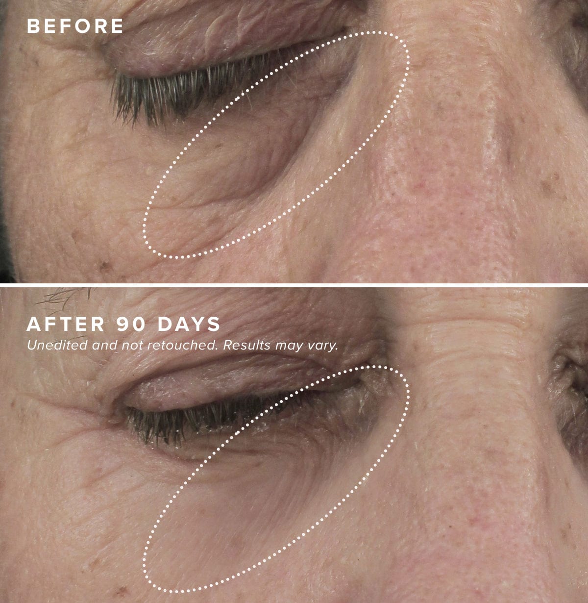 The Bright Eyes Set – DRMTLGY