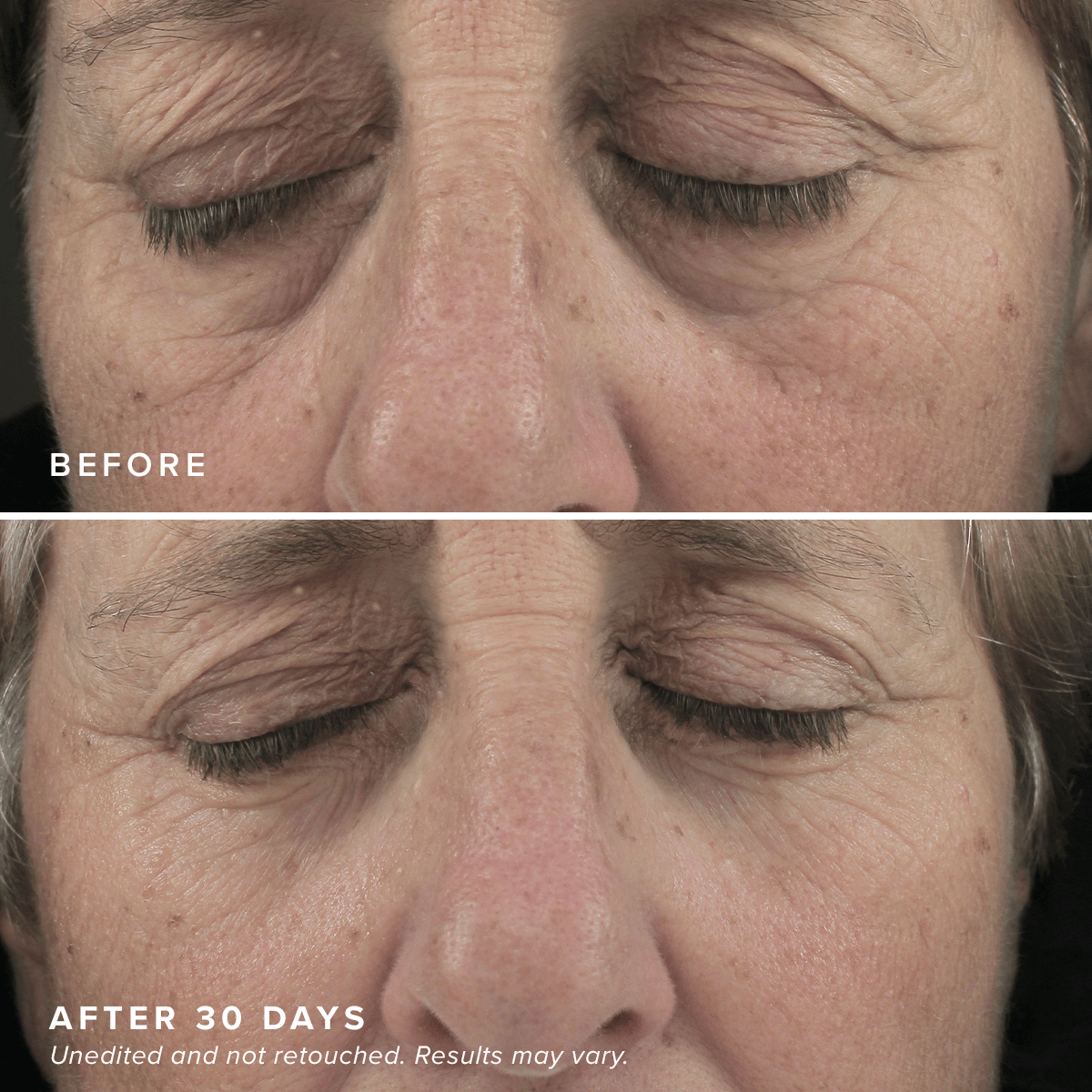 Mascarillas iluminadoras para ojos – DRMTLGY